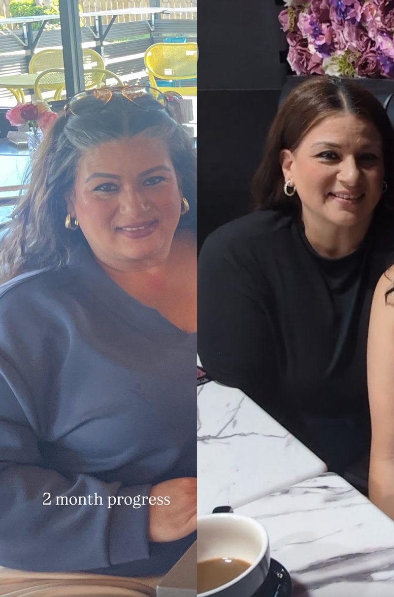 Irma, paciente de Clinic 45, antes y después, lado a lado, tras 2 meses de progreso